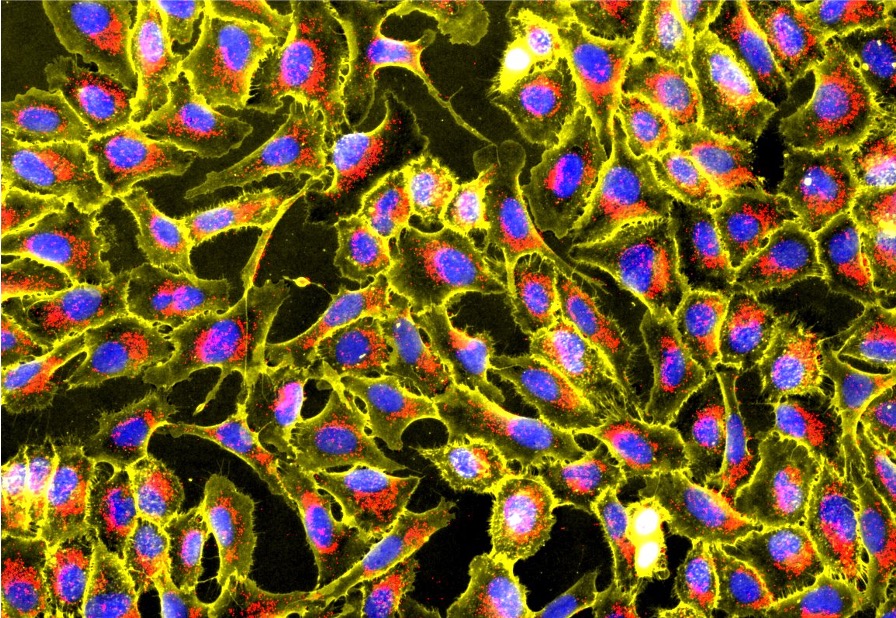 Cell Morphology
